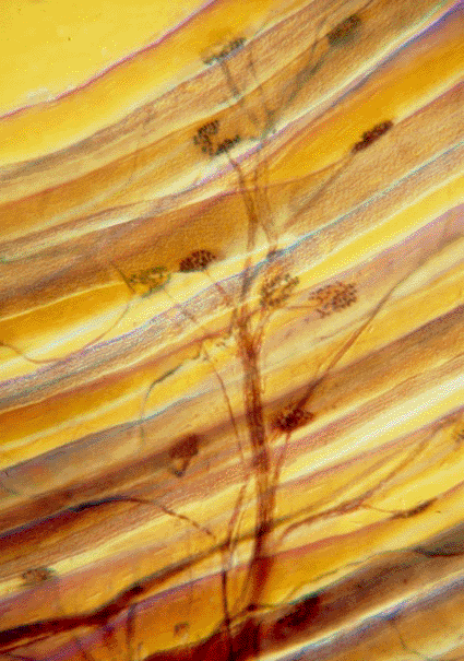 Image: Light micrograph of synapses between a motor neuron and skeletal muscle cells (Photo courtesy of Eric Grave / SPL).